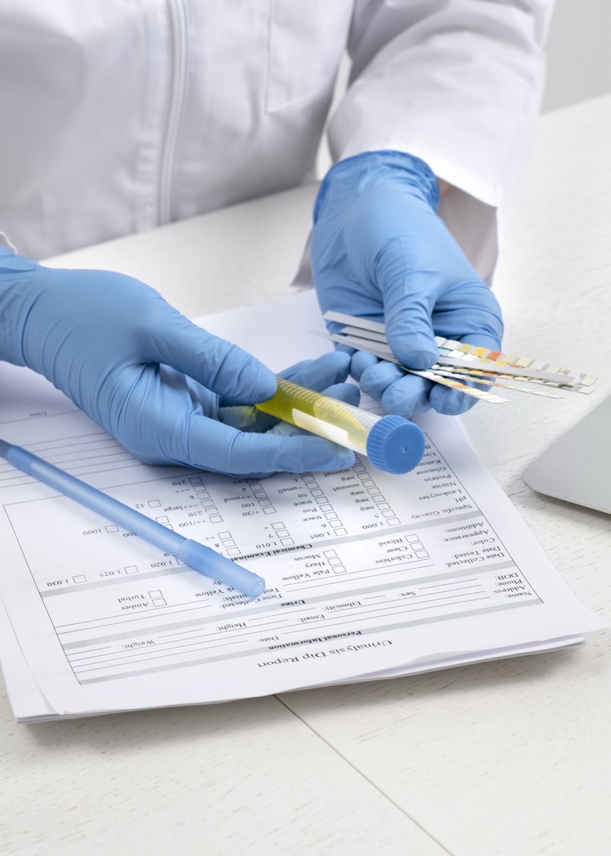 Gloved technician preparing a urine sample for testing